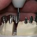 Ceramdent - laborator dentar